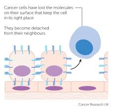 In today's health minute, we look at pancreatic cancer and why it's so dangerous. Cancer Cells Cancer Research Uk