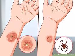 Pin On Wikihow Tips Tricks