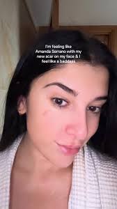 Amanda Serrano Boxing Eye Cut After