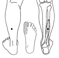 Learn about common causes of numbness in the most common cause of toe numbness is tight footwear. Numbness In Big Toe