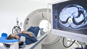 Surgery which can be successful to remove early breast, bowel and a number of other cancers, doesn't work in lymphoma. Lymphoma Symptoms Treatments Causes Tests Preventions