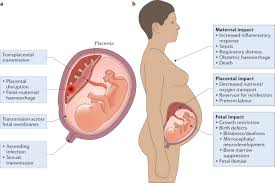 Infections At The Maternal Fetal Interface An Overview Of Pathogenesis And Defence Nature Reviews Microbiology