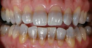 We did not find results for: Colgate Oral Health Network Free Dental Continuing Education