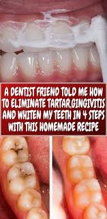Here S The Recipe If You Re Wondering How To Get Rid Of Tooth Tartar With Walnut Shell Homemade Recipes Natural Remedies For Allergies Gingivitis
