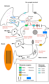 .the disease mechanism of amyotrophic lateral sclerosis (als), also known as lou gehrig's disease. Molecular And Cellular Pathways Of Neurodegeneration In Motor Neurone Disease Journal Of Neurology Neurosurgery Psychiatry