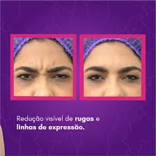 GiOlaser Rudge Ramos