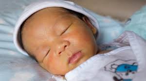Bayi dengan penyakit kuning akan mempunyai kulit dan bahagian putih mata yang berwarna kuning. Bayi Kuning Berita Kesehatan Balita Terbaru