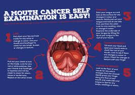 This type of cancer can develop in a number of places, including the lips, inner lining of the cheeks, salivary glands, gums, tongue, hard palate and soft palate. An Introduction To Oral Cancer Dental Supplies And Equipment Dentaltix