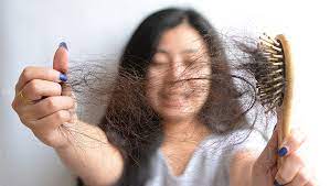 This type of hair loss is called traction alopecia. Why Is Your Hair Falling Out Rush Hair Beauty