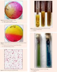 The severity of the disease depends on host factors. Figure 4 From Prevalence Of Salmonella Spp On Exterior And Interior Of Fertile Eggs From Vaccinated Breeding Hens Of Different Breeds Semantic Scholar