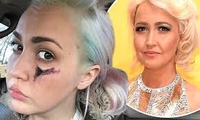 The Voice's Meghan Linsey opens up