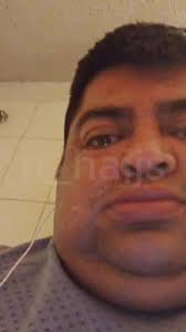 Que Le Pasó Al Albert Andrés