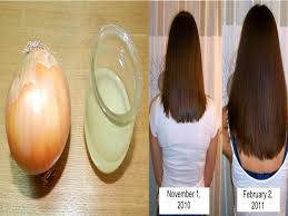 To use this remedy all you need to do is to break an egg and apply it directly to your hair. How To Grow Hair Naturally Fast Using Onion Juice And Eggs Get Rid Of Frizzy Hair Youtube