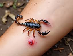 Scorpion Bite Treatment Options and Care