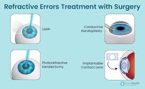 Image result for Refractive Error