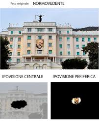 Fondazione casa sollievo della sofferenza, opera di san pio da pietrelcina. Irccs Casa Sollievo Della Sofferenza Auf Twitter Oculistica Casasollievo Attivato Ambulatorio Ipovisione E Riabilitazione Visiva Prenotazioni Tel 0882410217 Https T Co Fjzauerbrj Https T Co Utwqfvvzmm
