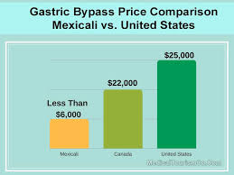 Gastric Bypass In Mexicali Mexico