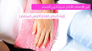 انفجار أكياس المبايض تعرف عليه ويب طب