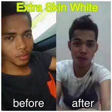 Extra skin white(esw) sachets adalah supplement tambahan untuk merawat semua jenis masalah kulit dan sesuai semua. Facebook