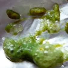 Giardien beim hund (stinkender durchfall) symptome, auswirkungen und behandlung.colitis ulcerosa bauchschmerz. á… Der Stuhlgang Bei Babys Was Ist Normal Tipps Hinweise