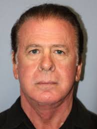 Facelift Before and After Photos by Larry Nichter, MD; Newport Beach, CA