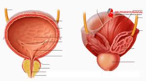 This can also cause rectal bleeding, so check if they is blood in your stool. 5 Warning Signs Of Prostate Cancer Dr Pradeep Bansal Urologist Specialist Youtube
