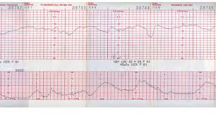 normal fetal heart rate by week things you didnt know