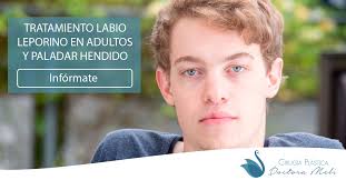 Gracias por seguir y darle like a esta página/ comunidad que se ha creado para informar, educar, compartir experiencias, ayudar y apoyar a personas con labio leporino y paladar hendido. Labio Leporino En Adultos Y Paladar Hendido Doctora Meli
