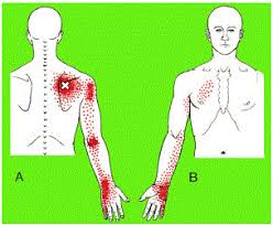 Pin On Back Pain Spinal Conditions
