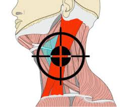 Pressure point fighting techniques that simply promote transitory dizziness are inadequate for real world self defense conditions. How To Knock Someone Out