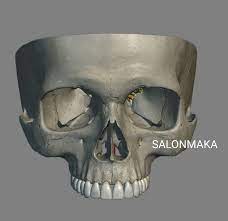 顔の重心を上げるお手軽な方法 顔 頭蓋骨 美容整形