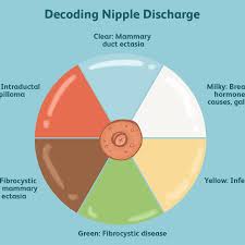 Nipple Discharge Symptoms Causes Diagnosis And Treatment