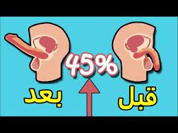 مرهم طبيعي لتقوية الانتصاب في شهر كامل se7atona