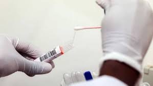 El ministro de salud, óscar ugarte, manifestó que la variante lambda del coronavirus ya había sido reportada como la predominante en el país. 8bxcqcwqr9wxwm