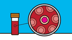 We may be a step closer to this outcome with a team of american scientists now developing a blood test that can detect cancer at thus, the blood test can detect cancer even before clinical symptoms appear. Blood Tests Detecting Cancer In Blood Cancer Research Uk Cancer News