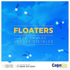 cagin goz hastanesi gozde ucusan cisimler floaters facebook