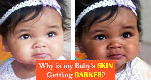 We did not find results for: Baby S Skin Color And Effective Tips To Lighten And Whiten It