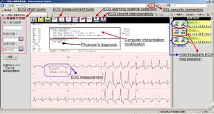 The Web Accessed 12 Lead Ecg Visualization And Management