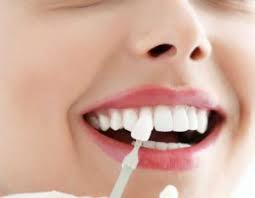 أشهر 7 عيادات تلبيس الاسنان في جدة الأخيرة ستسعد بعروضها I أهل السعودية