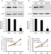 Costar® 12sir, 12v system co alarm. Human Epithelial Type Ovarian Tumour Marker Beta 2 Microglobulin Is Regulated By The Tgf B Signaling Pathway Journal Of Translational Medicine Full Text
