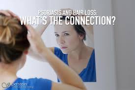 Scalp psoriasis is the specific affliction of psoriasis occurring on the scalp, although it often spreads to the forehead, ears and neck as well. Balding Patches With Psoriasis How Does It Link To Hair Loss