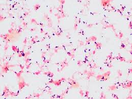 It is a facultative anaerobic bacterium, capable of surviving in the presence or absence of oxygen. Listeria Meningitis An Inconsistent Organism Causing An Inconsistent Disease The American Journal Of Medicine