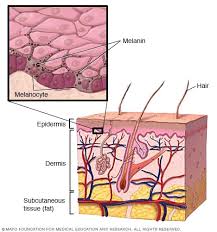 sunburn symptoms and causes mayo clinic