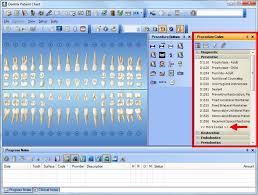 Dentrix Tip Tuesdays Customizing The Procedure Code List In