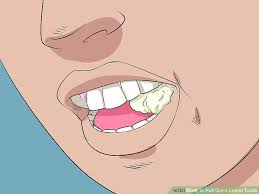 Those are fine, sometimes necessary, and often. How To Pull A Tooth At Home Homelooker