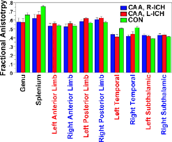 White Matter Alterations In Cerebral Amyloid Angiopathy