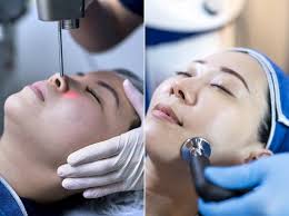 “i cannot be more pleased with ah laser aesthetics. Laser Treatment For Hyperpigmentation Review Bespoke Aesthetics Singapore Thebeaulife