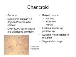 Chancroid Medical Symptoms And Signs Of Chancroid Sexually Transmitted Diseases Antiinfectivemeds Com