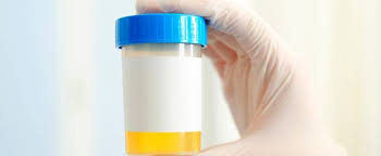 Blut Im Urin Ursachen Symptome Und Behandlung