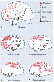 Image result for Higher Integrative Function